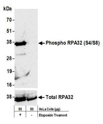 Western Blot: RPA2 [p Ser4, p Ser8] Antibody [NBP1-23017]